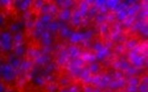 Type 1 collagen matrix production